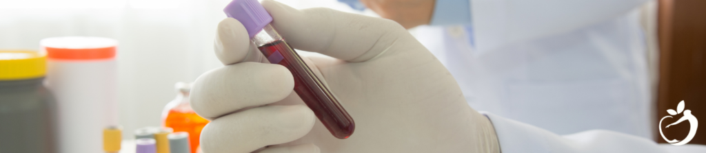All About Blood Sugar. What Can Be Done for High Blood Sugar? Image of blood collection tube.