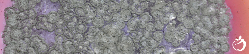 mold under a microscope