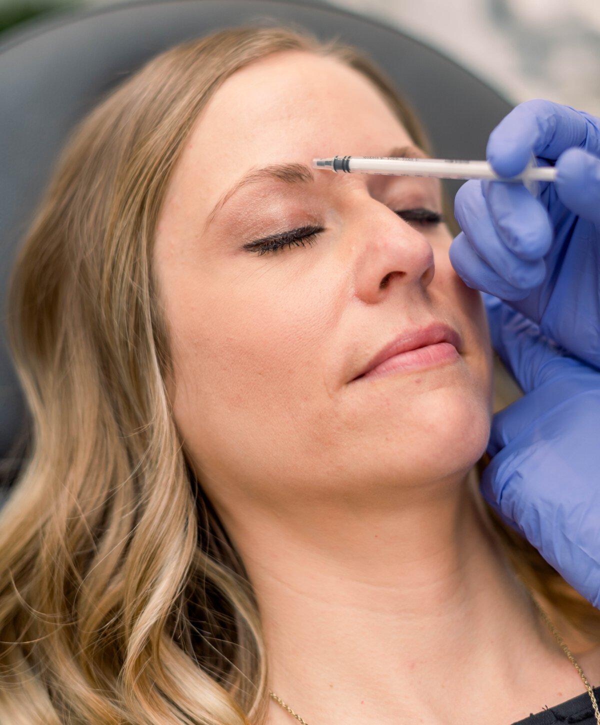Carmel dermal fillers patient model receiving treatment at her brow